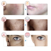 Altersglühen - 7 -Farben -LED -Therapiemaske für Gesichtsaufhebung und Aufhellung 4