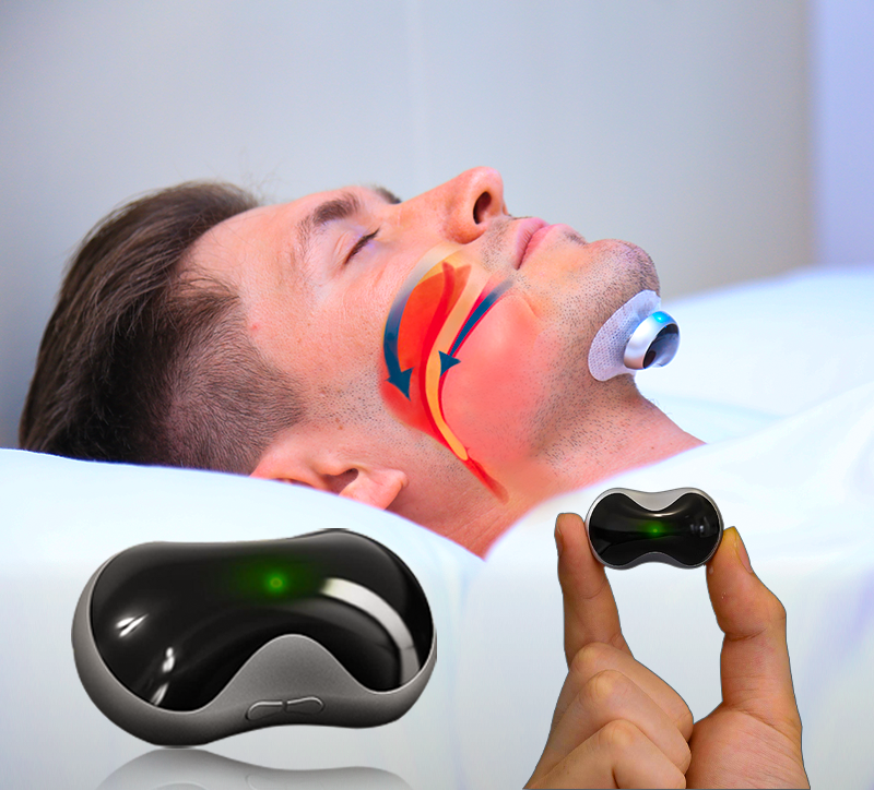Anti-Schnarchen-Gerät mit Elektrostimulationstechnologie-Bequemes Schnarchen-Mundstück für eine bessere Schlafqualität 0