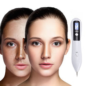 Clearskinpro -Laser -Plasma -Stift - Nicht -invasiv | Für Sommersprossen, Hautmarke, Fleck, Maulwurf und Tattoo zu Hause entfernen 3