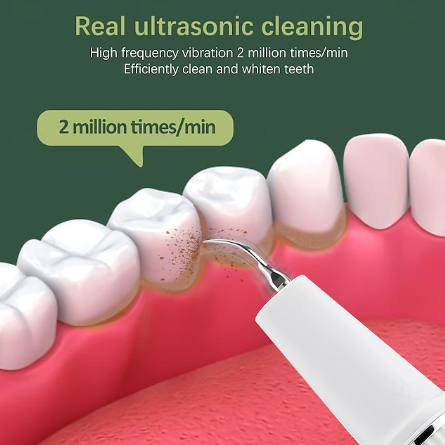 Dentora | Professioneller Ultraschall-Zahnsteinentferner für effektive Zahnpflege zu Hause 3